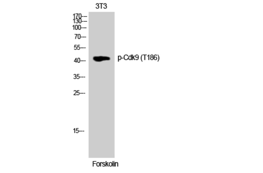 Western Blot - Anti-CDK9 (phospho Thr186) Antibody (A1028) - Antibodies.com