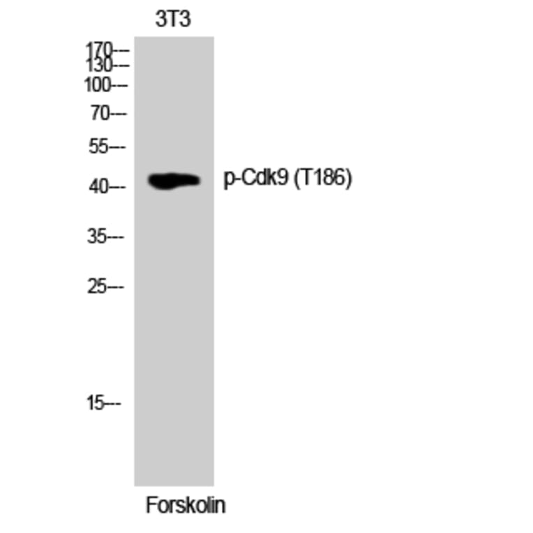 Western Blot - Anti-CDK9 (phospho Thr186) Antibody (A1028) - Antibodies.com