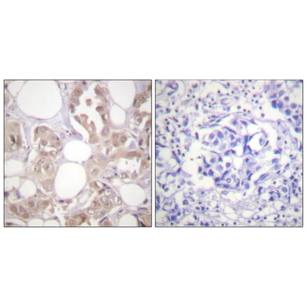 Immunohistochemistry - Anti-CDK7 (phospho Thr170) Antibody (A0857) - Antibodies.com