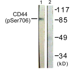 Western Blot - Anti-CD44 (phospho Ser706) Antibody (A0847) - Antibodies.com