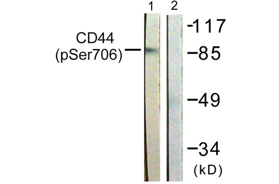 Western Blot - Anti-CD44 (phospho Ser706) Antibody (A0847) - Antibodies.com