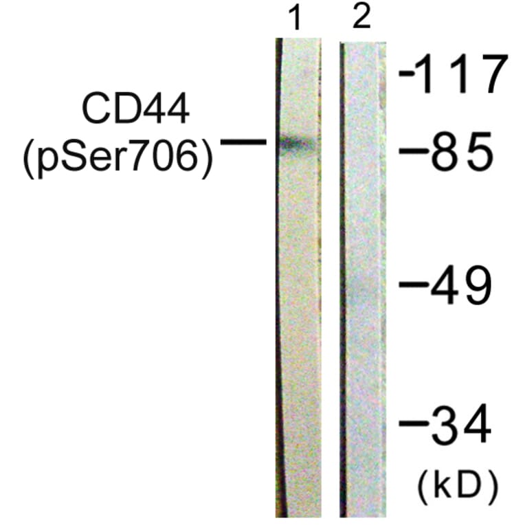 Western Blot - Anti-CD44 (phospho Ser706) Antibody (A0847) - Antibodies.com