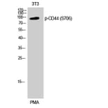 Western Blot - Anti-CD44 (phospho Ser706) Antibody (A0847) - Antibodies.com