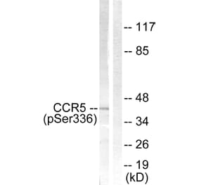 Western Blot - Anti-CCR5 (phospho Ser336) Antibody (A0061) - Antibodies.com