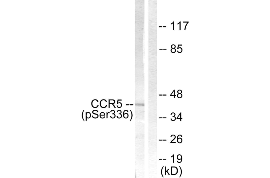 Western Blot - Anti-CCR5 (phospho Ser336) Antibody (A0061) - Antibodies.com