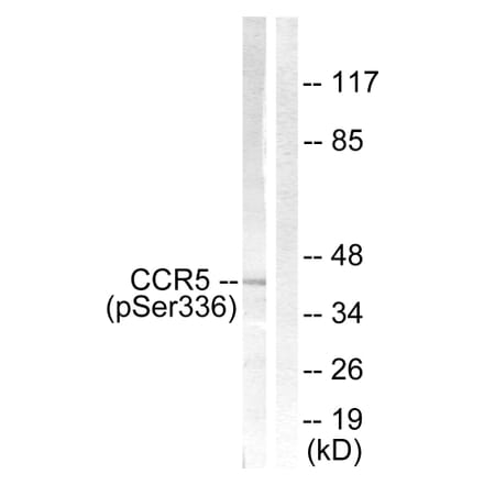 Western Blot - Anti-CCR5 (phospho Ser336) Antibody (A0061) - Antibodies.com