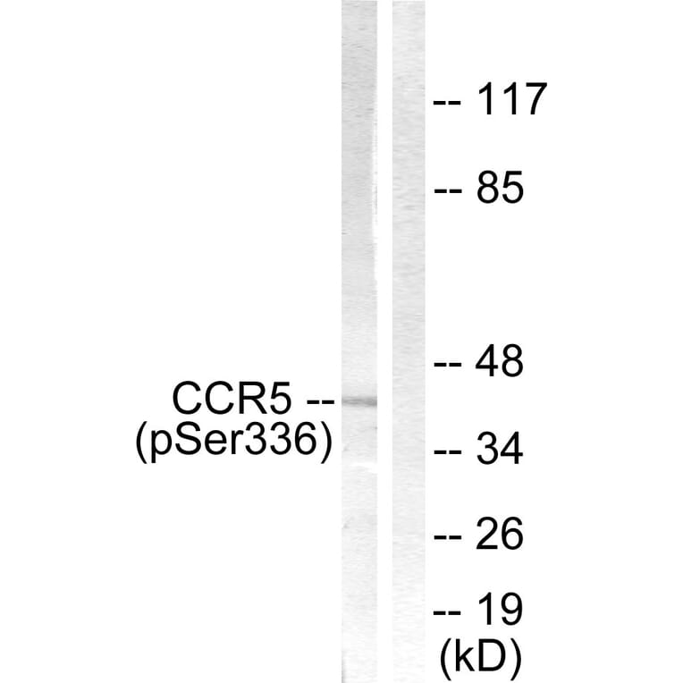 Western Blot - Anti-CCR5 (phospho Ser336) Antibody (A0061) - Antibodies.com