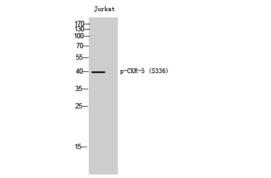 Western Blot - Anti-CCR5 (phospho Ser336) Antibody (A0061) - Antibodies.com