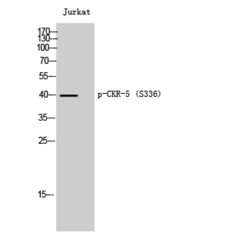 Western Blot - Anti-CCR5 (phospho Ser336) Antibody (A0061) - Antibodies.com