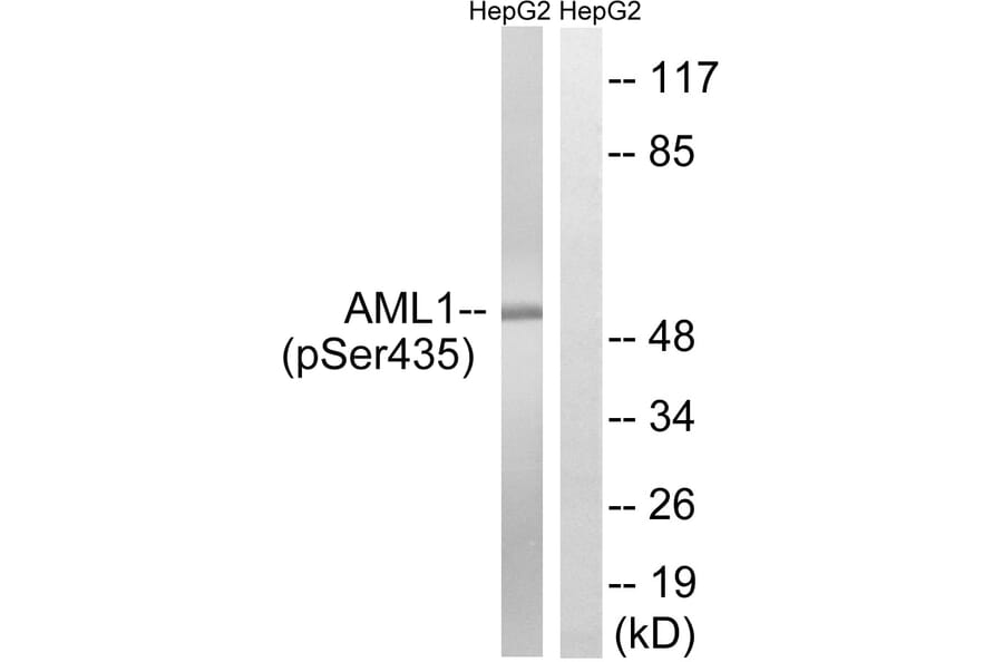 Western Blot - Anti-AML1 (phospho Ser435) Antibody (A8287) - Antibodies.com