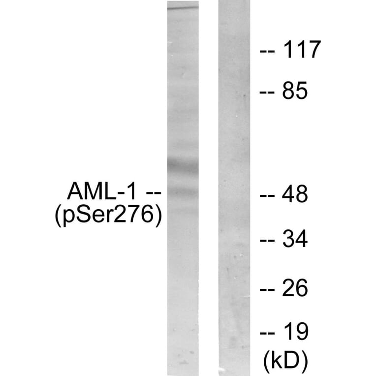 Western Blot - Anti-AML1 (phospho Ser276) Antibody (A0408) - Antibodies.com