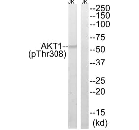 Western Blot - Anti-AKT1 (phospho Thr308) Antibody (A8483) - Antibodies.com