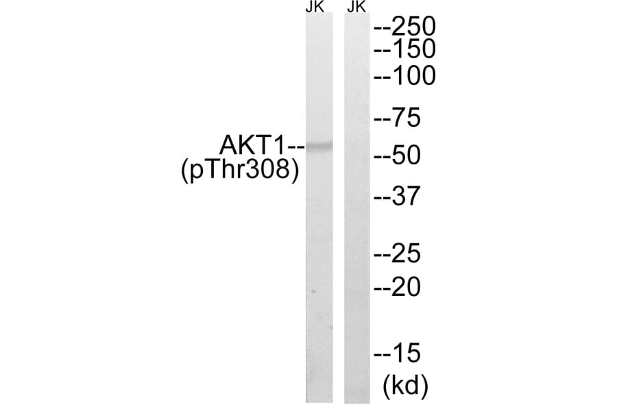 Western Blot - Anti-AKT1 (phospho Thr308) Antibody (A8483) - Antibodies.com