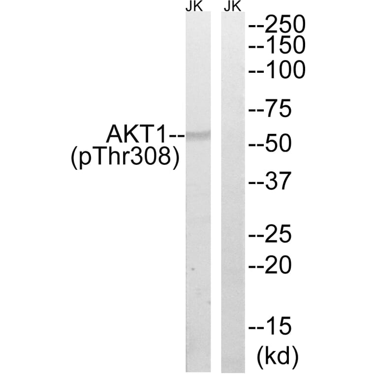 Western Blot - Anti-AKT1 (phospho Thr308) Antibody (A8483) - Antibodies.com