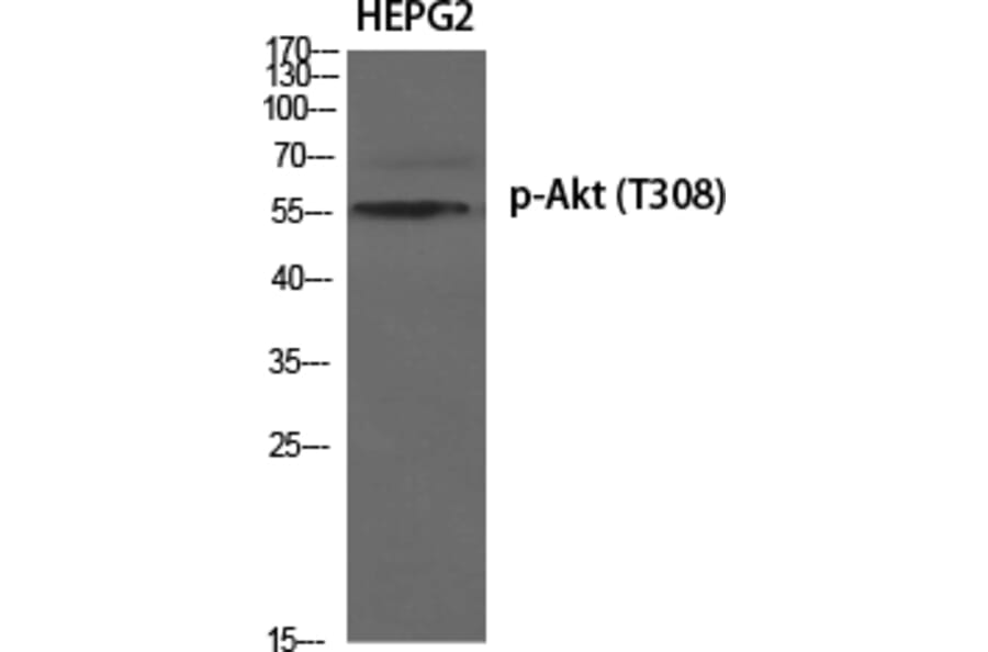 Western Blot - Anti-AKT1 (phospho Thr308) Antibody (A8483) - Antibodies.com