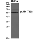 Western Blot - Anti-AKT1 (phospho Thr308) Antibody (A8483) - Antibodies.com