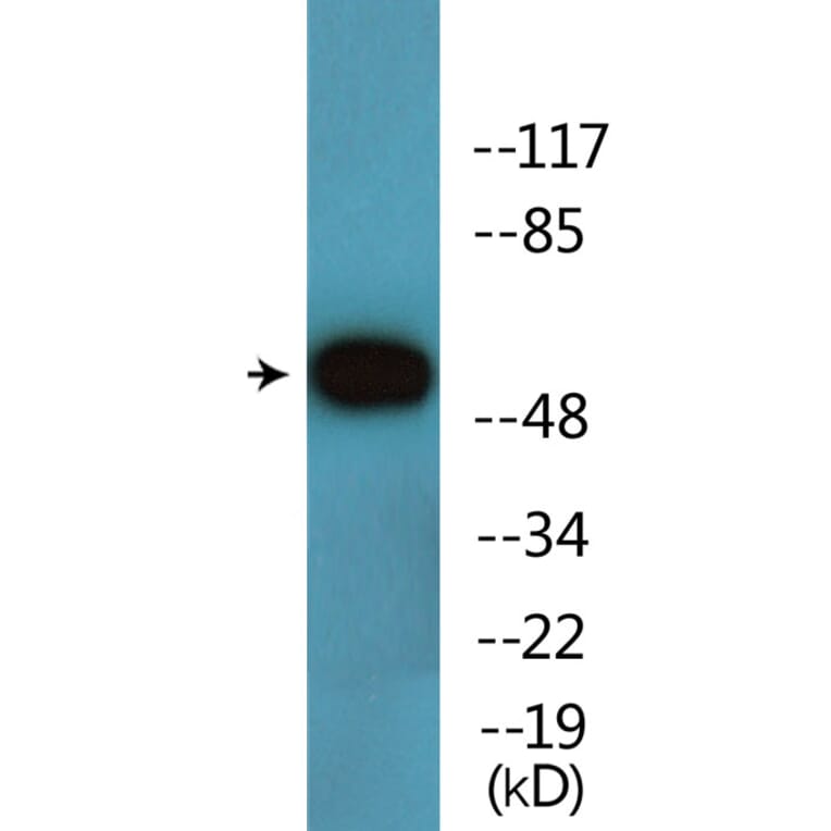 Western Blot - Anti-AKT1 (phospho Thr308) Antibody (P12-1073) - Antibodies.com