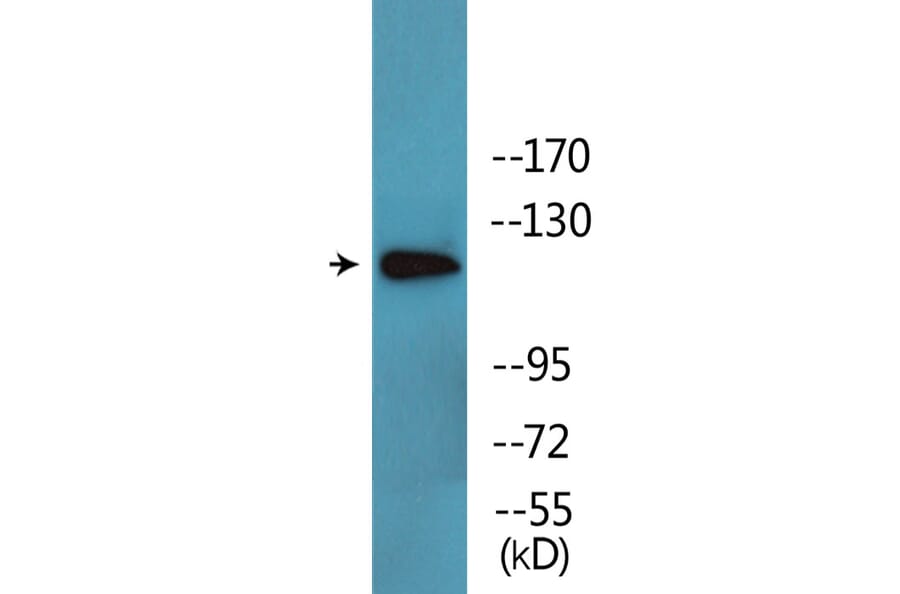 Western Blot - Anti-ABL1 (phospho Thr735) Antibody (P12-1071) - Antibodies.com
