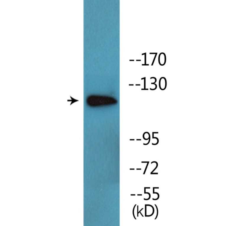 Western Blot - Anti-ABL1 (phospho Thr735) Antibody (P12-1071) - Antibodies.com