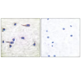 Immunohistochemistry - Anti-Tau (phospho Thr212) Antibody (A7246) - Antibodies.com