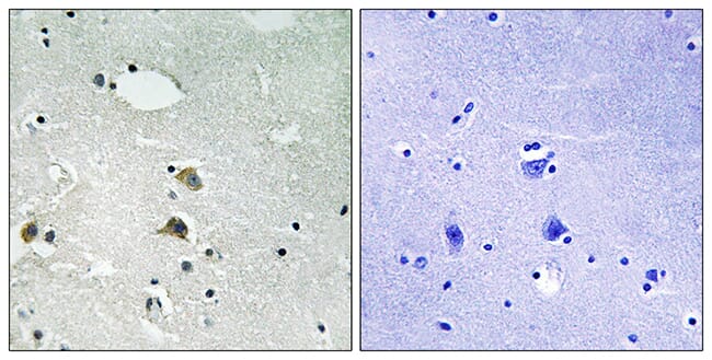 Immunohistochemical analysis of paraffin-embedded human brain tissue using Anti-S6 Ribosomal Protein Antibody. The right hand panel represents a negative control, where the antibody was pre-incubated with the immunising peptide.