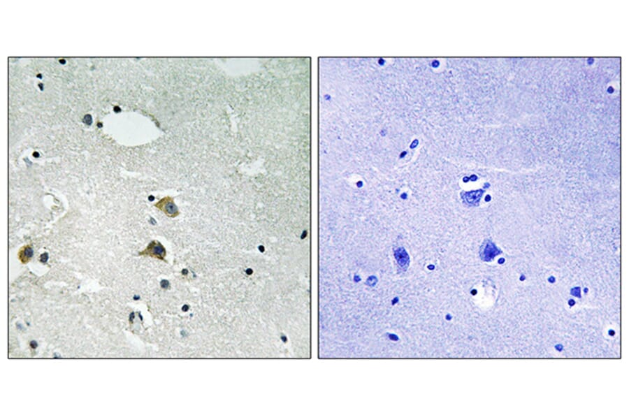 Immunohistochemistry - Anti-S6 Ribosomal Protein Antibody (B8413) - Antibodies.com