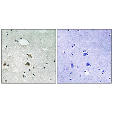 Immunohistochemistry - Anti-S6 Ribosomal Protein Antibody (B8413) - Antibodies.com