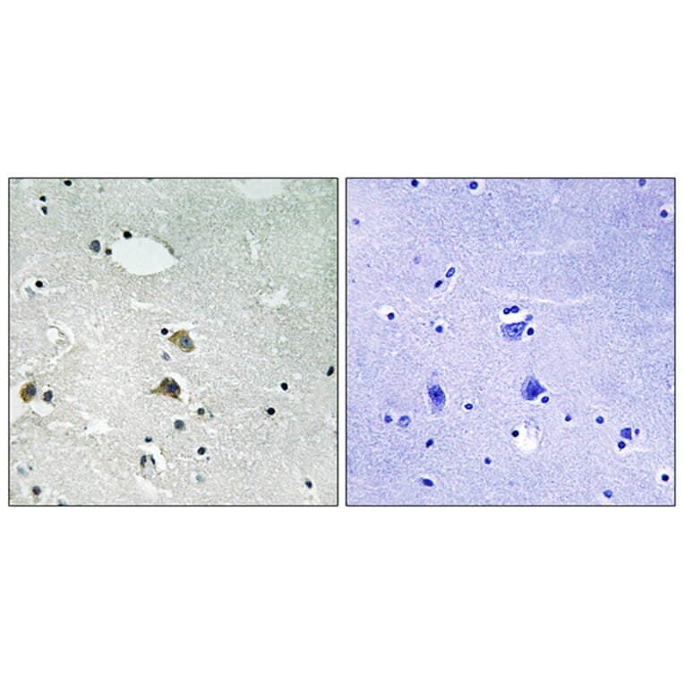 Immunohistochemistry - Anti-S6 Ribosomal Protein Antibody (B8413) - Antibodies.com