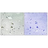 Immunohistochemistry - Anti-S6 Ribosomal Protein Antibody (B8413) - Antibodies.com