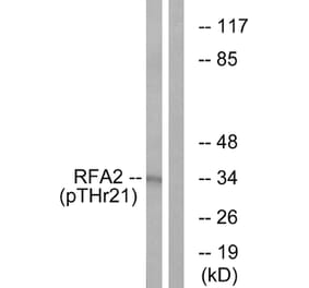 Western Blot - Anti-RFA2 (phospho Thr21) Antibody (A0985) - Antibodies.com