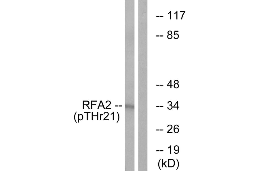 Western Blot - Anti-RFA2 (phospho Thr21) Antibody (A0985) - Antibodies.com