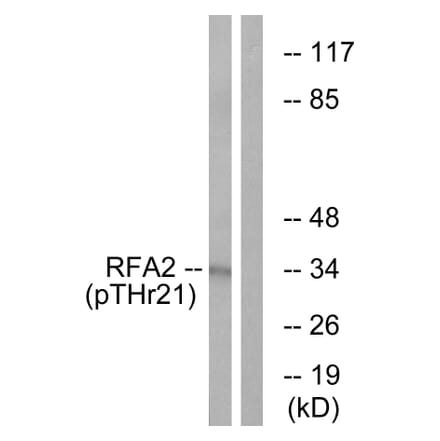 Western Blot - Anti-RFA2 (phospho Thr21) Antibody (A0985) - Antibodies.com