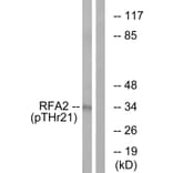 Western Blot - Anti-RFA2 (phospho Thr21) Antibody (A0985) - Antibodies.com