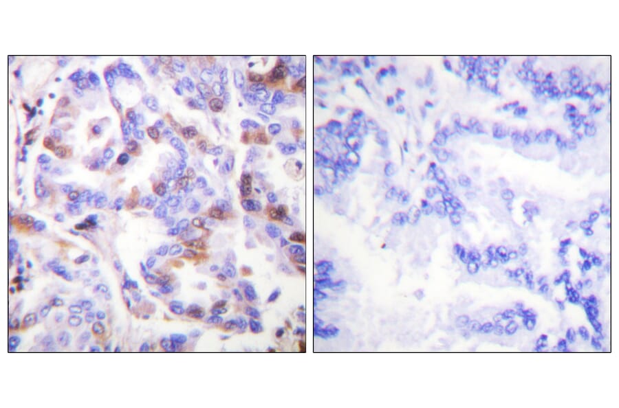 Immunohistochemistry - Anti-RFA2 (phospho Thr21) Antibody (A0985) - Antibodies.com