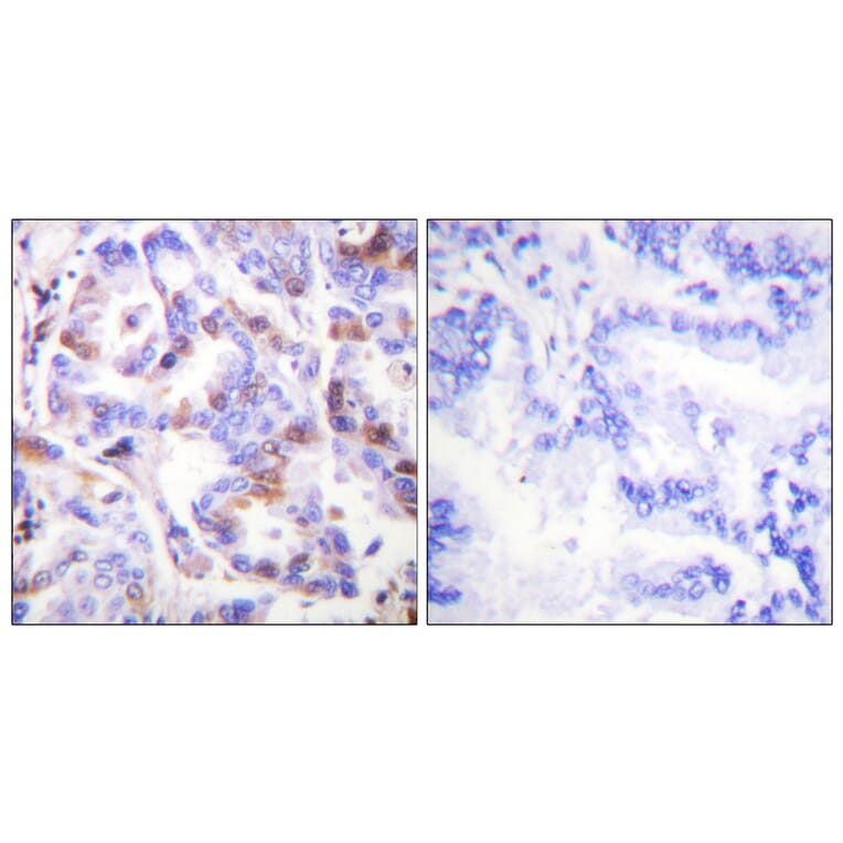 Immunohistochemistry - Anti-RFA2 (phospho Thr21) Antibody (A0985) - Antibodies.com