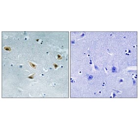 Immunohistochemistry - Anti-p53 (phospho Ser376) Antibody (A8052) - Antibodies.com