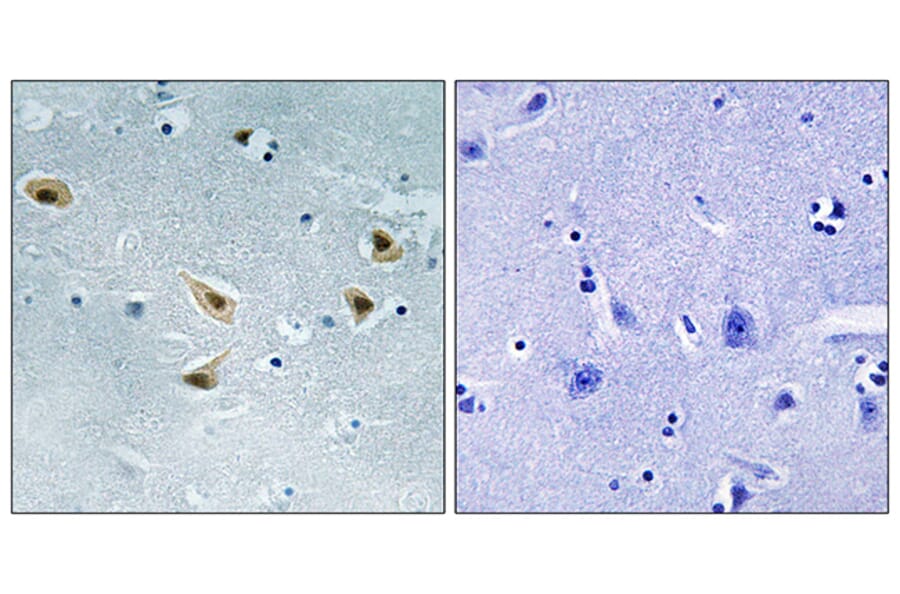 Immunohistochemistry - Anti-p53 (phospho Ser376) Antibody (A8052) - Antibodies.com