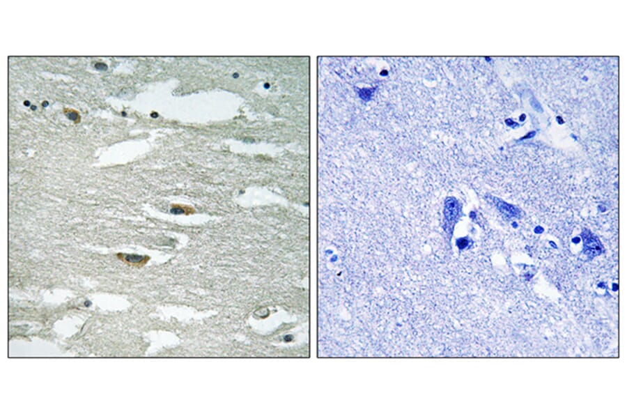Immunohistochemistry - Anti-ILK (phospho Ser246) Antibody (A8115) - Antibodies.com