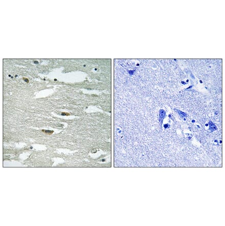 Immunohistochemistry - Anti-ILK (phospho Ser246) Antibody (A8115) - Antibodies.com