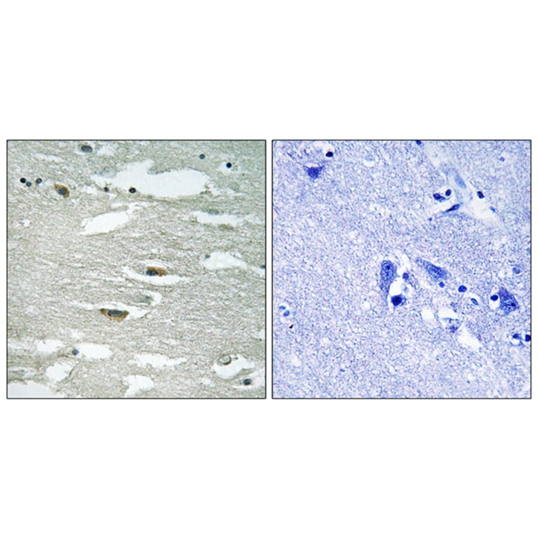 Immunohistochemistry - Anti-ILK (phospho Ser246) Antibody (A8115) - Antibodies.com
