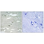 Immunohistochemistry - Anti-ILK (phospho Ser246) Antibody (A8115) - Antibodies.com