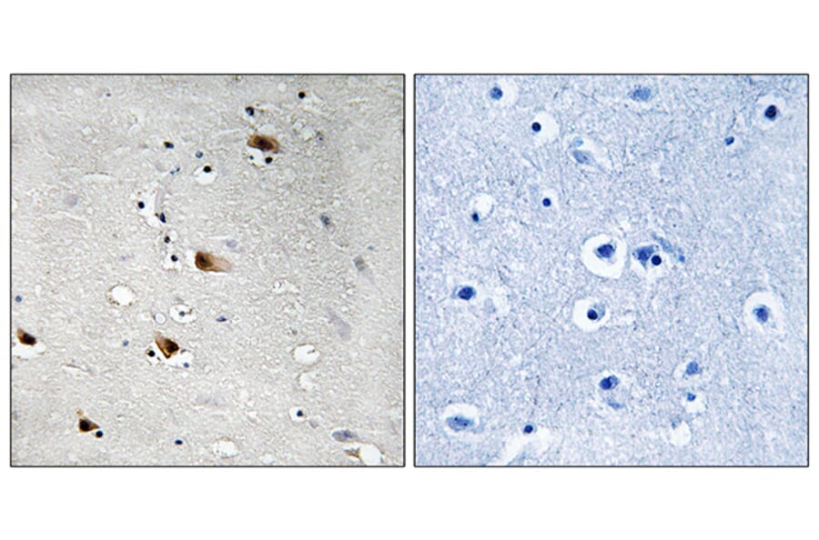 Immunohistochemistry - Anti-E2A (phospho Thr355) Antibody (A8339) - Antibodies.com