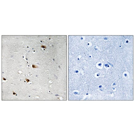 Immunohistochemistry - Anti-E2A (phospho Thr355) Antibody (A8339) - Antibodies.com