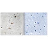 Immunohistochemistry - Anti-E2A (phospho Thr355) Antibody (A8339) - Antibodies.com