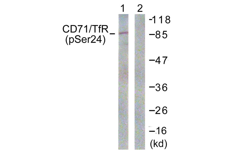 Western Blot - Anti-CD71 (phospho Ser24) Antibody (A0852) - Antibodies.com
