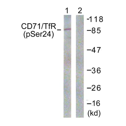 Western Blot - Anti-CD71 (phospho Ser24) Antibody (A0852) - Antibodies.com