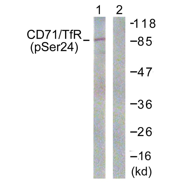 Western Blot - Anti-CD71 (phospho Ser24) Antibody (A0852) - Antibodies.com