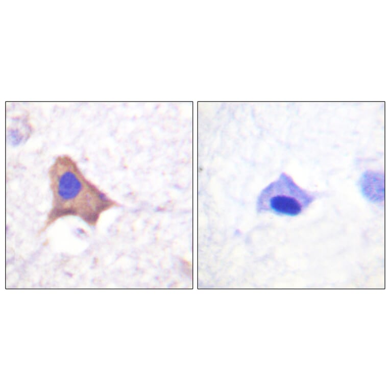 Immunohistochemistry - Anti-CD71 (phospho Ser24) Antibody (A0852) - Antibodies.com