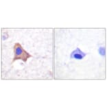 Immunohistochemistry - Anti-CD71 (phospho Ser24) Antibody (A0852) - Antibodies.com