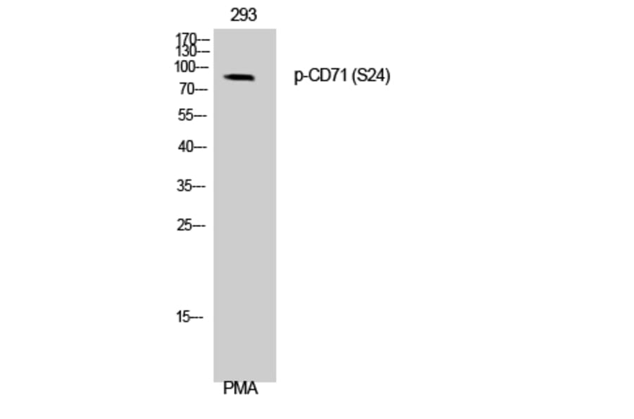 Western Blot - Anti-CD71 (phospho Ser24) Antibody (A0852) - Antibodies.com